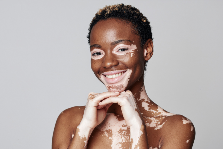 dermatologia em Curitiba