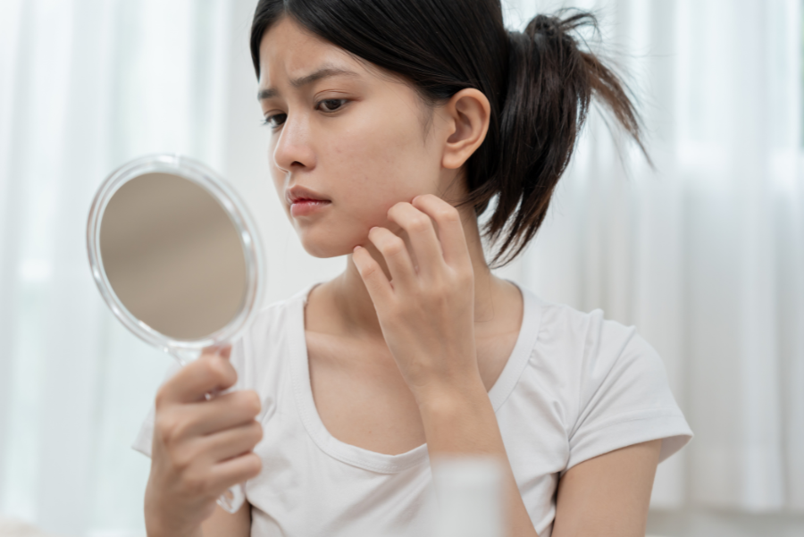 Quando procurar um dermatologista?