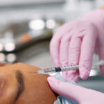 Aplicação de toxina botulínica em consultório de dermatologia