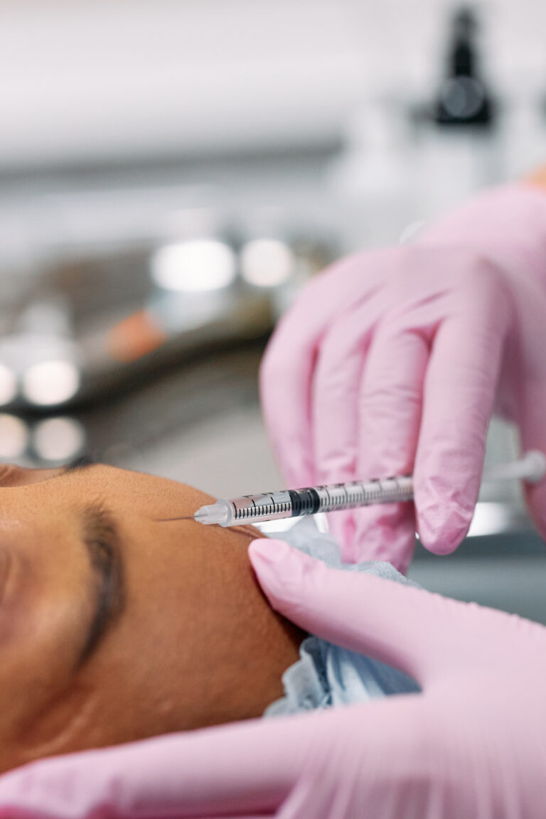 Aplicação de toxina botulínica em consultório de dermatologia