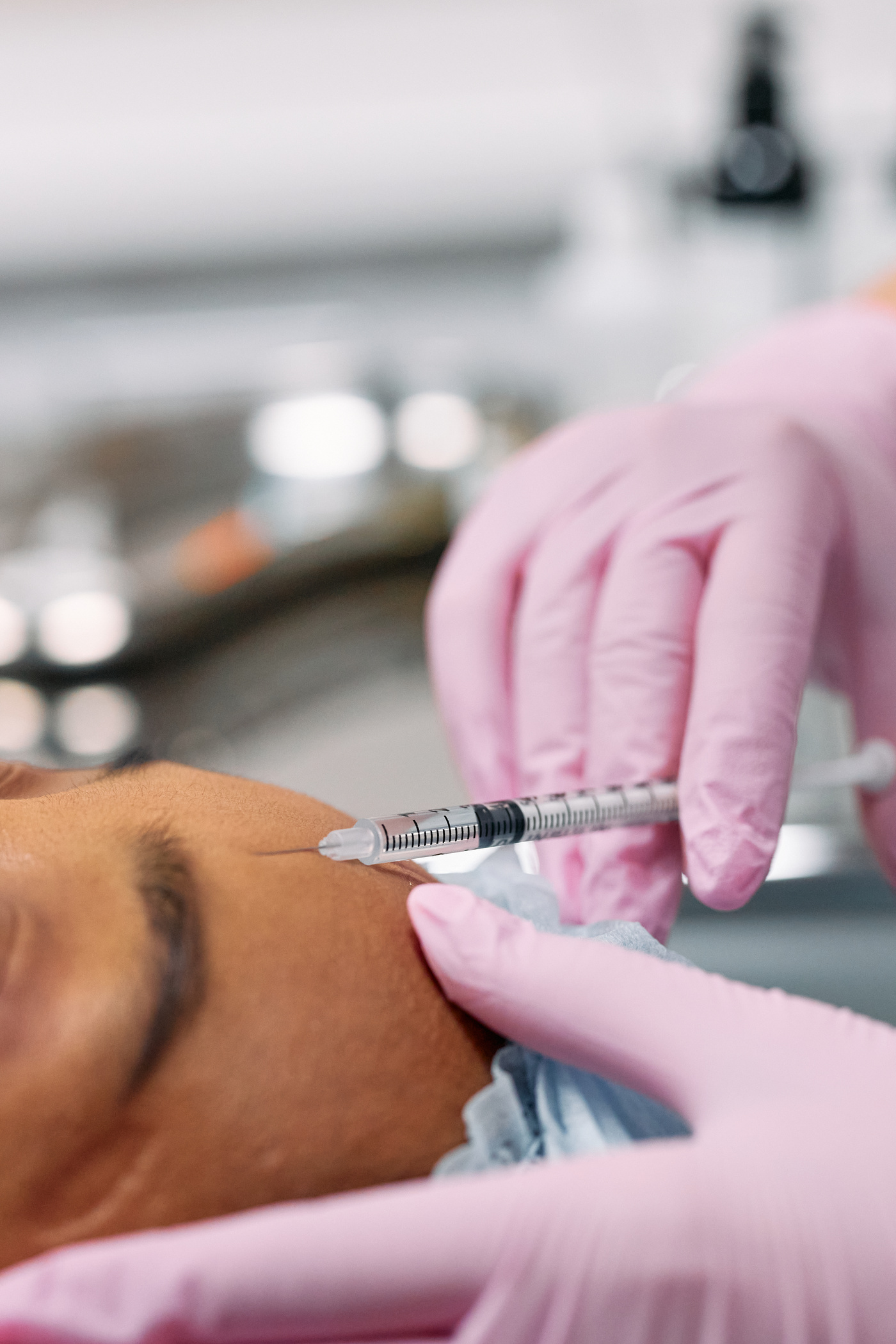 Aplicação de toxina botulínica em consultório de dermatologia