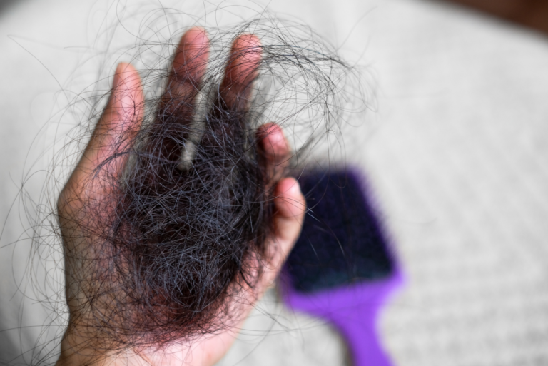 Queda de cabelo: o que é normal e quando procurar um dermatologista